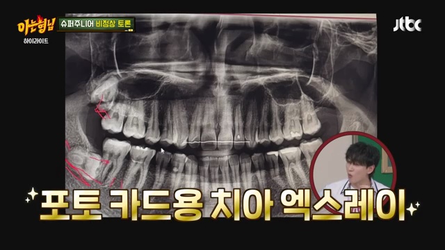 김희철의 짜증 에피소드! 생일파티에서 예상치 못한 사건😅 | 아는 형님 최고의 순간 포착 - 장면 3